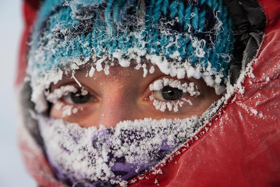 frozen nose.jpg