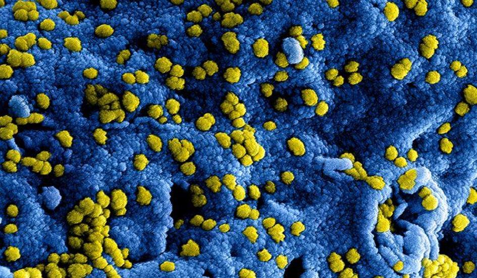 coronavirus.jpg